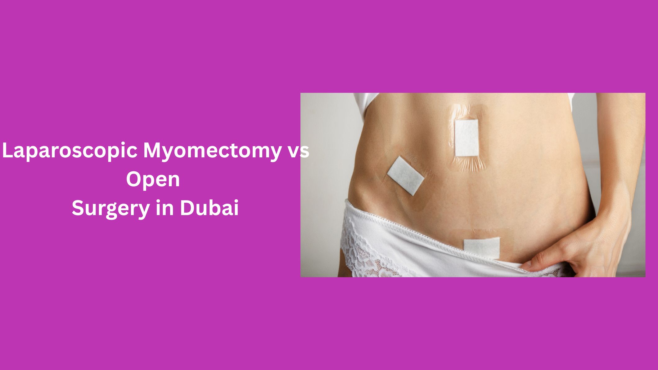 laparoscopic-myomectomy-vs-open-surgery-in-dubai