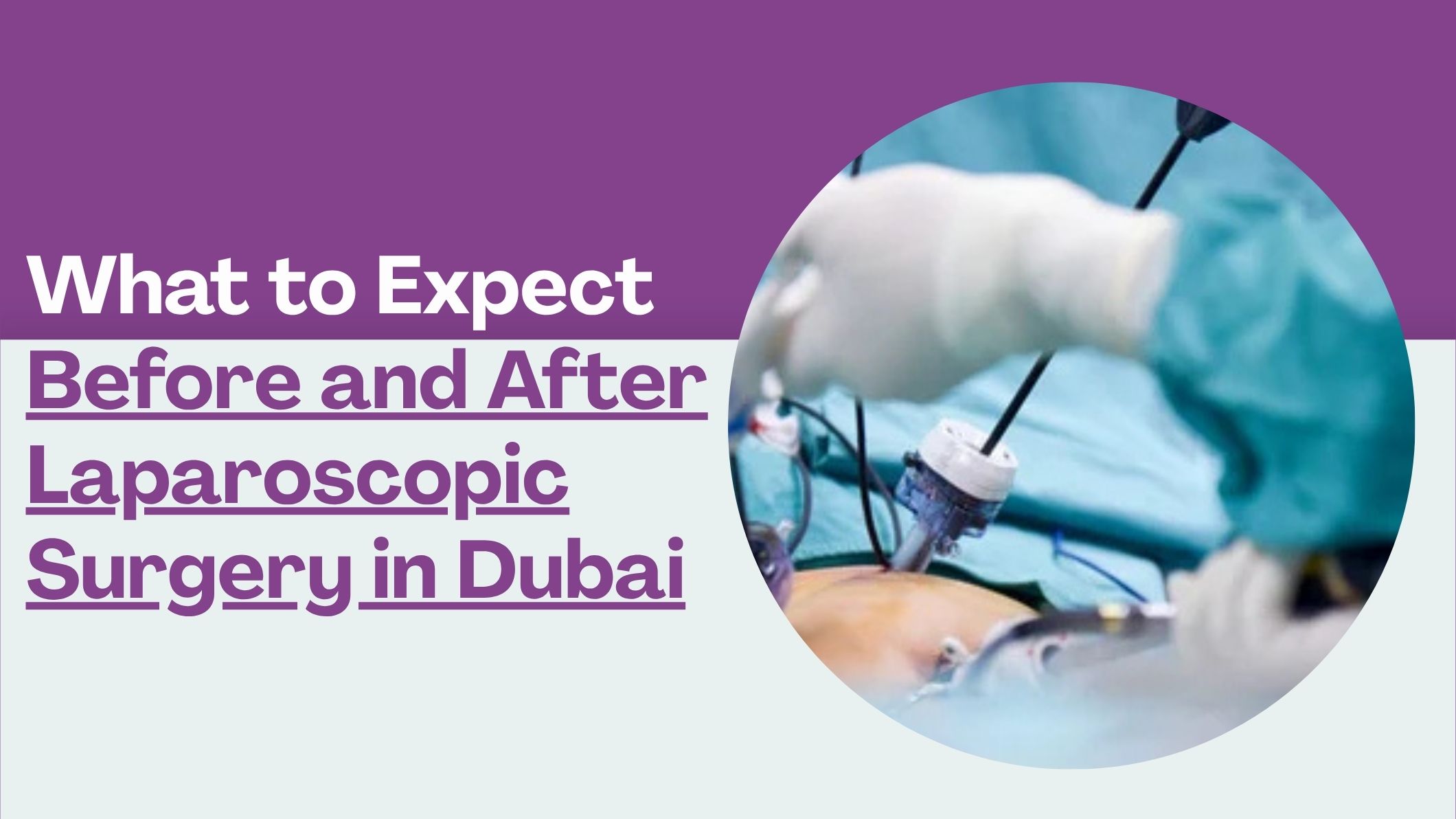 what-to-expect-before-and-after-laparoscopic-surgery-in-dubai