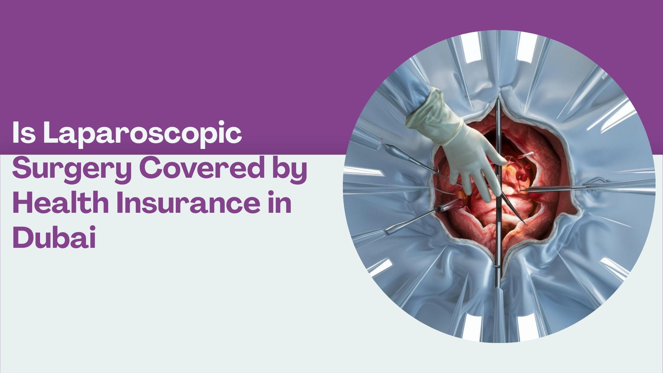 is-laparoscopic-surgery-covered-by-health-insurance-in-dubai