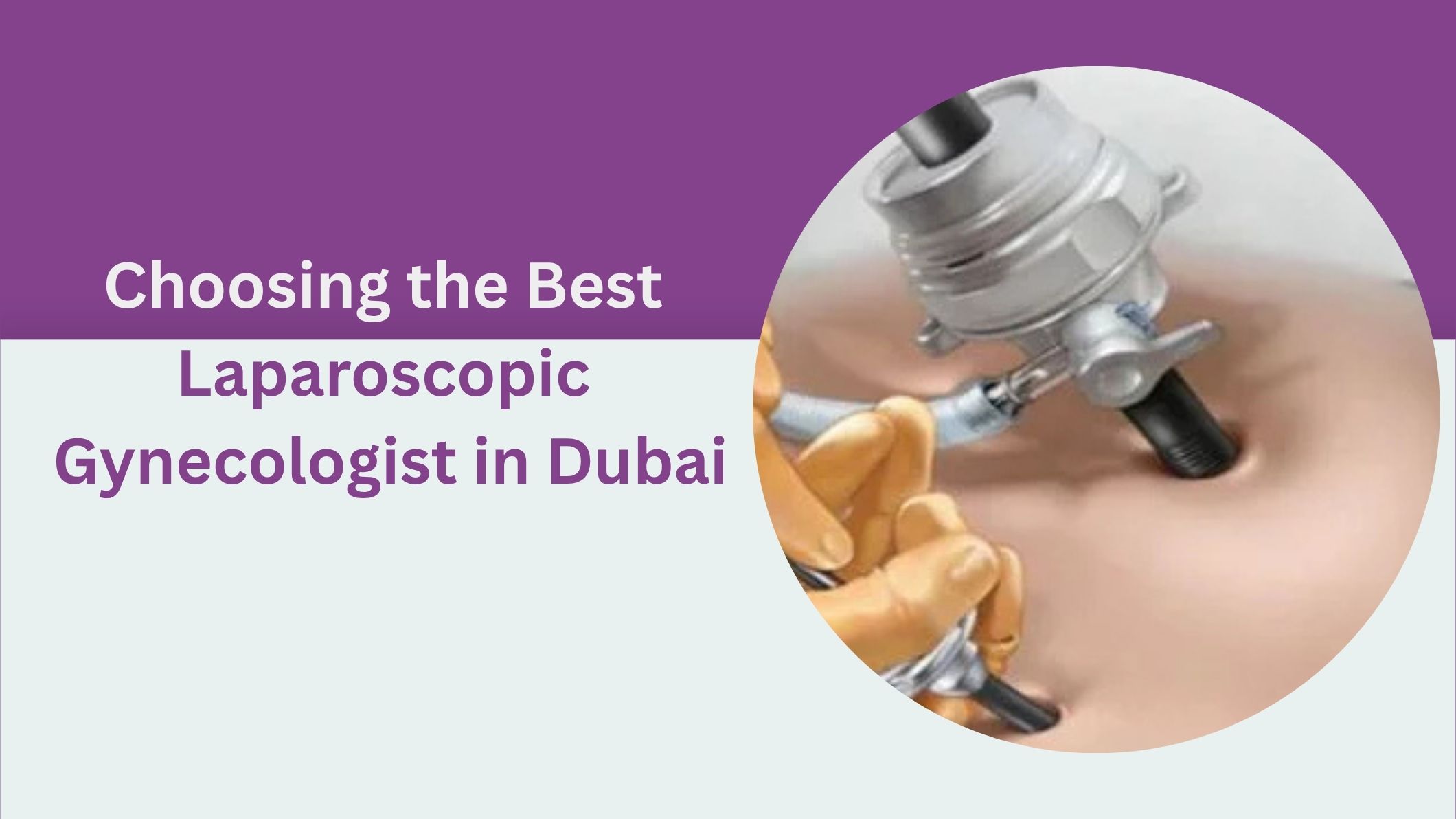 choosing-the-best-laparoscopic-gynecologist-in-dubai