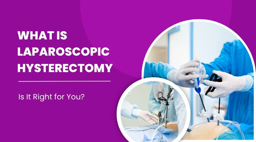 Laparoscopic Hysterectomy Laparoscopic Hysterectomy