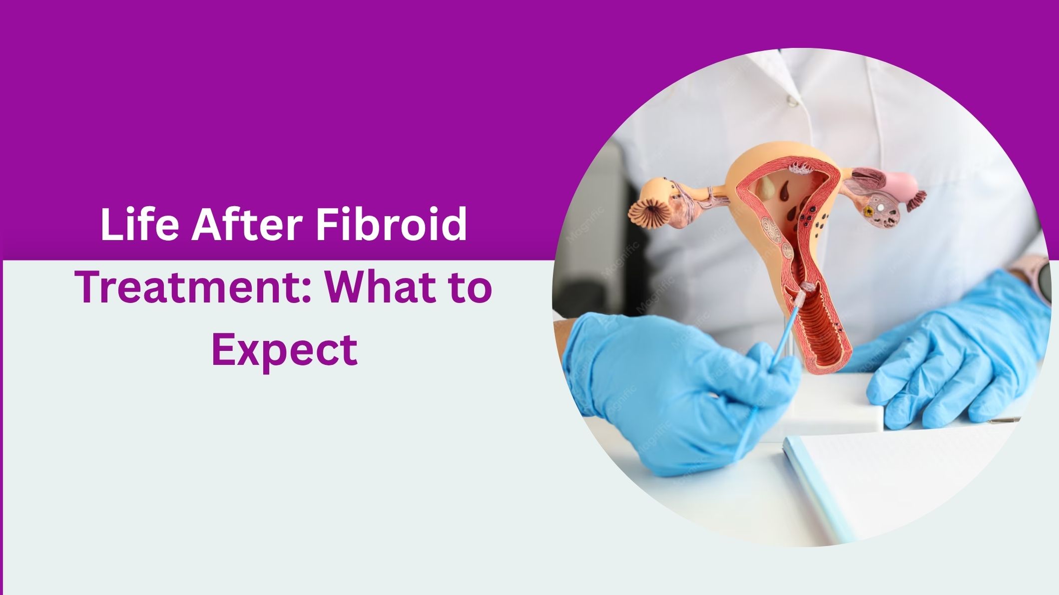 life-after-fibroid-treatment-what-to-expect