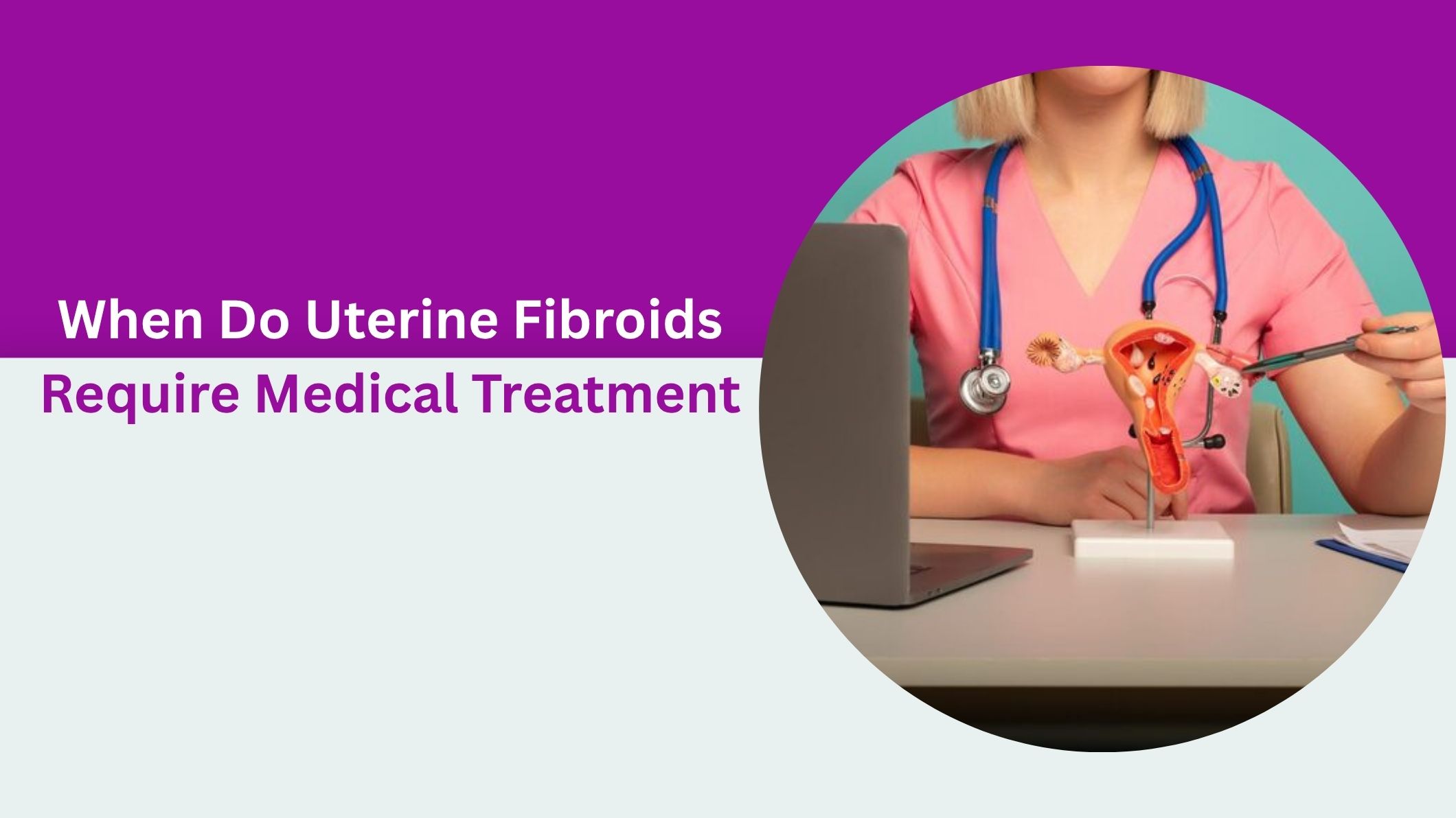 when-do-uterine-fibroids-require-medical-treatment