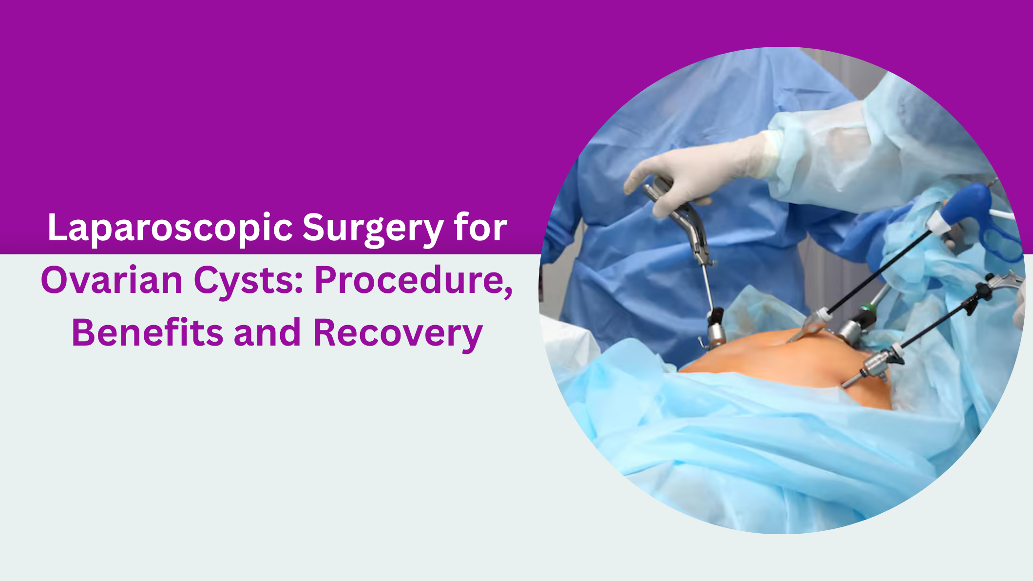 laparoscopic-surgery-ovarian-cysts-procedure-benefits-recovery