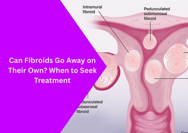 can-fibroids-go-away-on-their-own-when-to-seek-treatment
