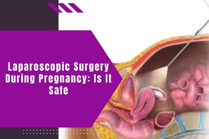 laparoscopic-surgery-during-pregnancy-is-it-safe