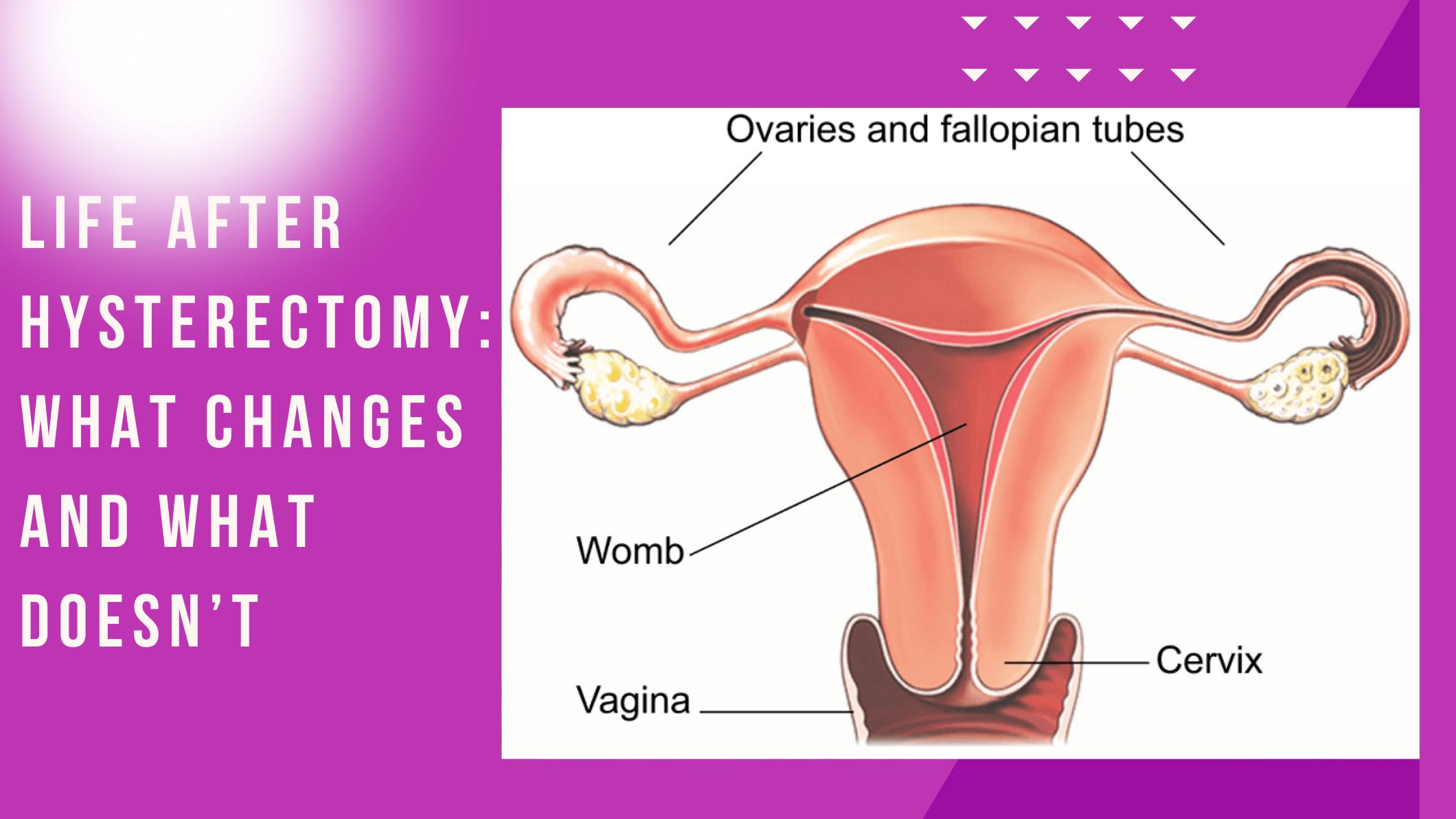 life-after-hysterectomy-what-changes-and-what-does-not