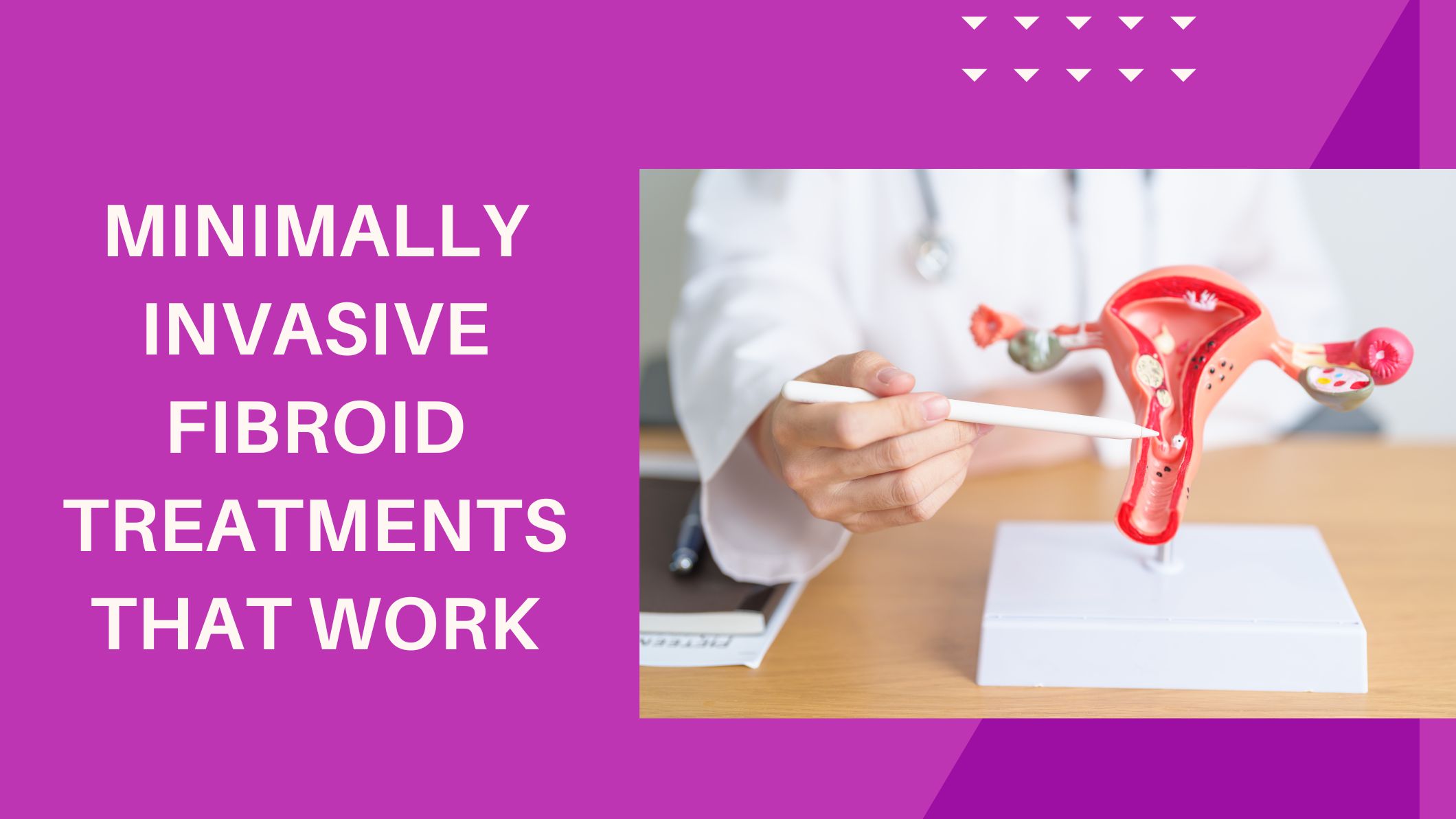 minimally-invasive-fibroid-treatments-that-work