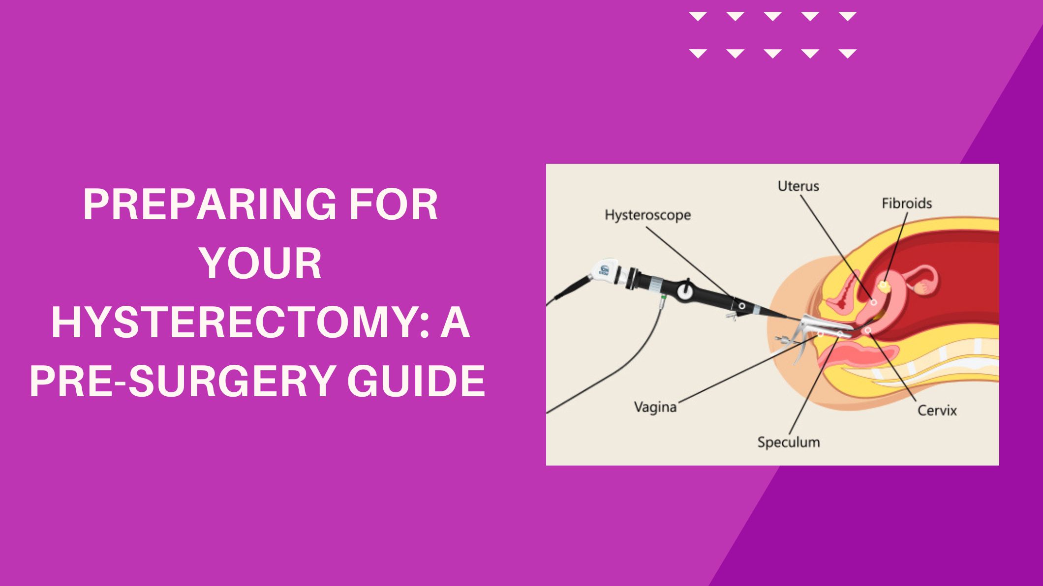 preparing-for-your-hysterectomy-pre-surgery-guide