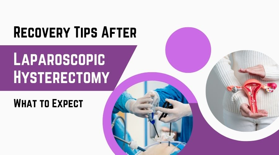 Laparoscopic Hysterectomy 