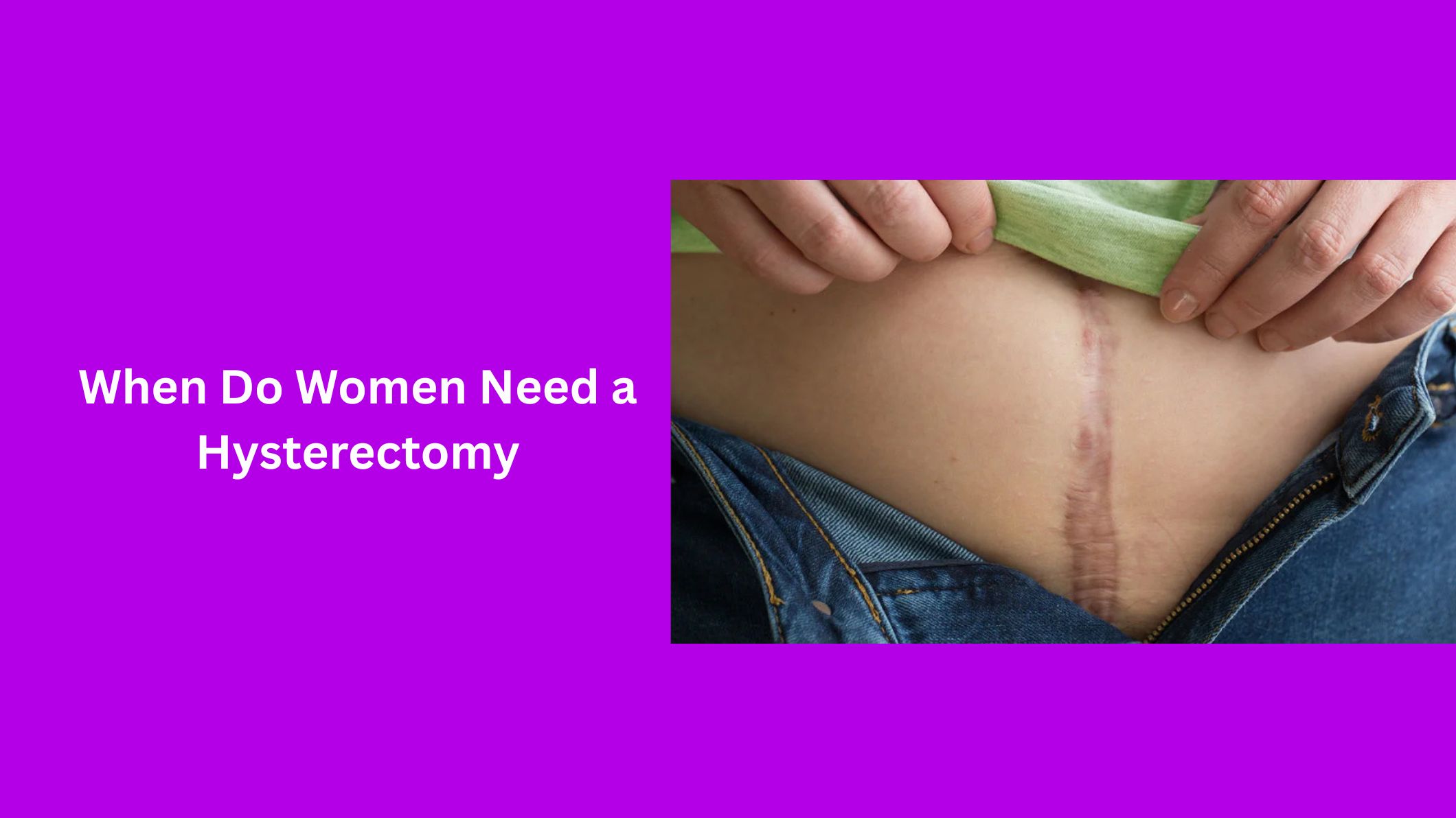 when-do-women-need-a-hysterectomy